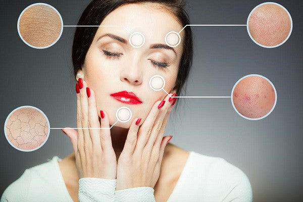 Treating Dry Skin: Use Moringa-Based Products